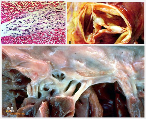 DIAGNOSTICO FIEBRE diagnostico fiebre: