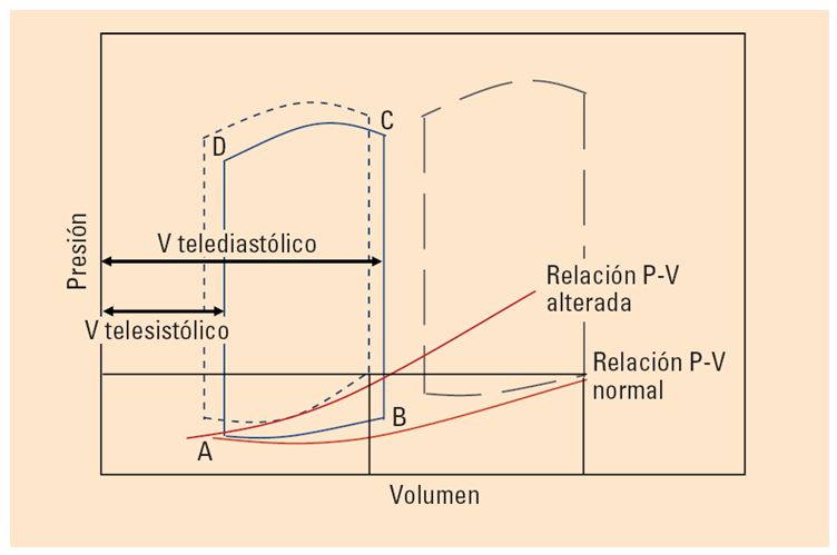 IC diastólica 2