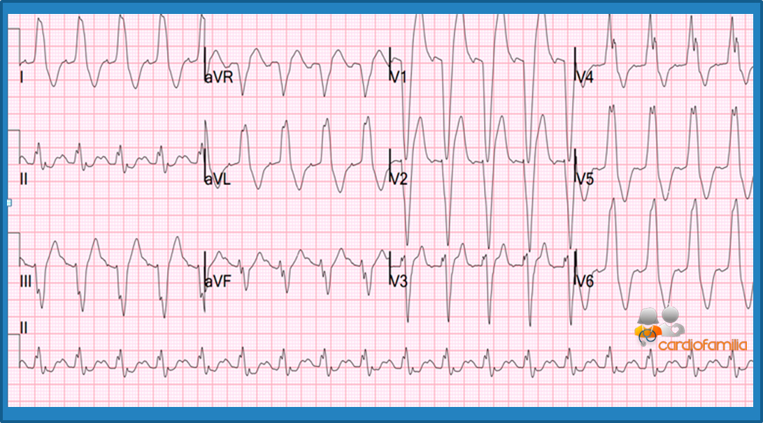 ECG14 2018 cardiofamilia 1