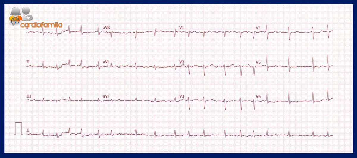 cardiofamilia 05.02 2018