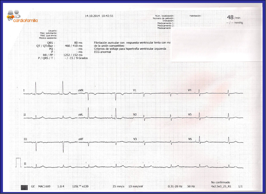 cardiofamilia ecg fa fal