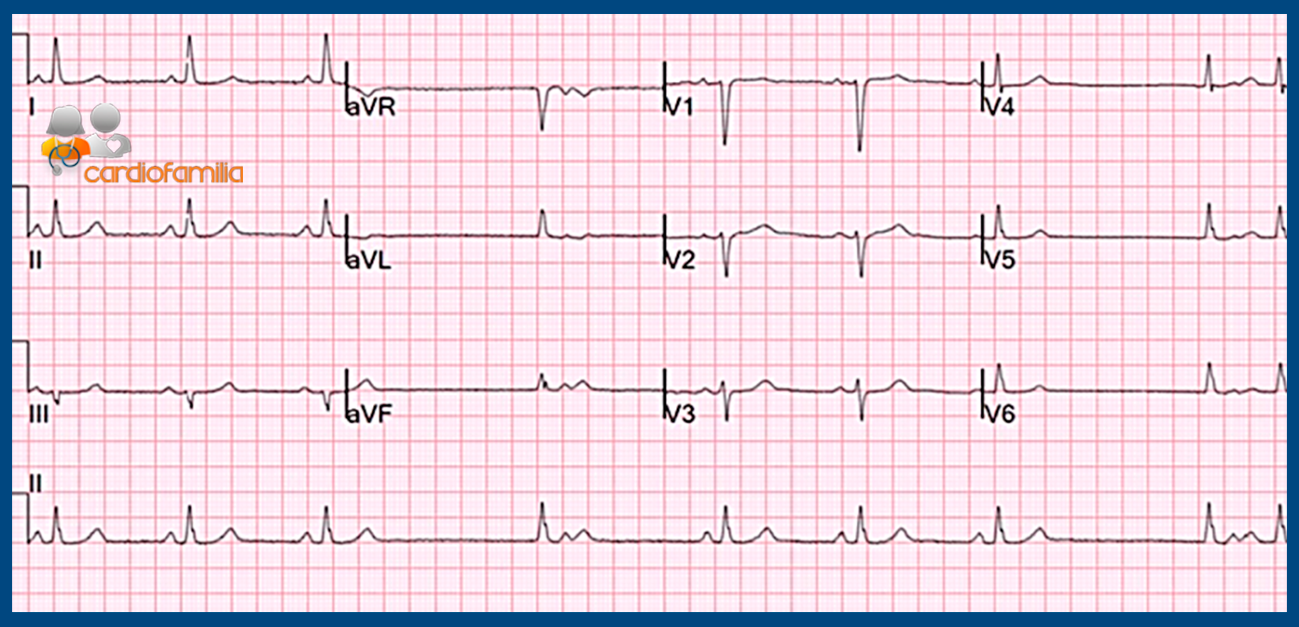 cardiofamilia 28.05.2018