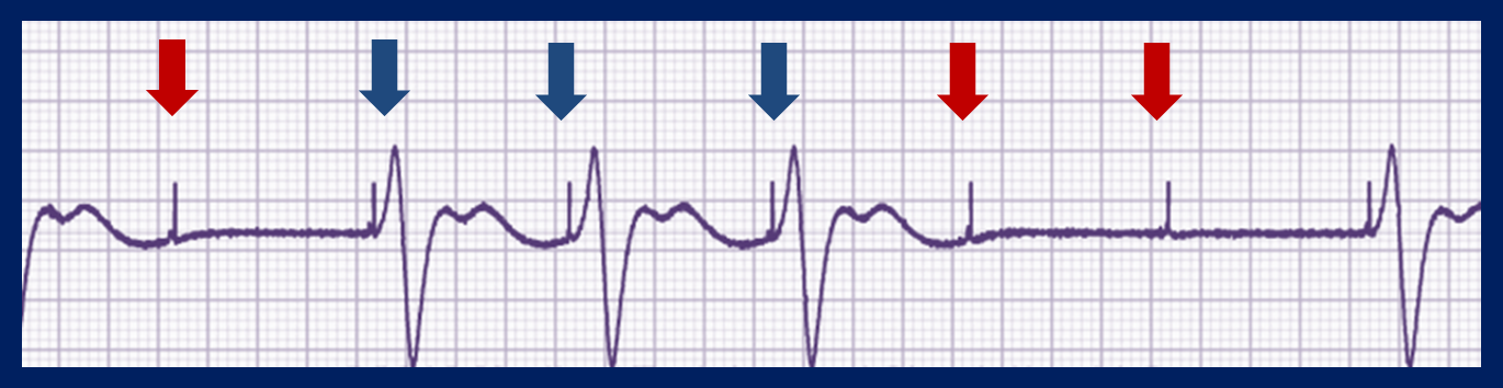 ecg 22.01.2018 cardiofamilia 2 resoluc