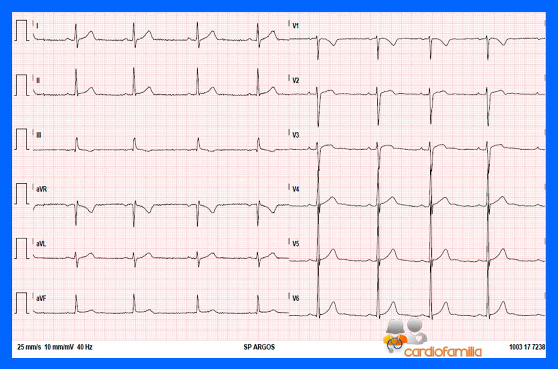 ecg cardiofamilia 05.07