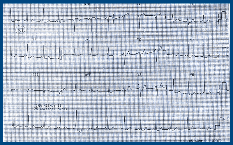 electro 11.01.2018.cardiofamilia