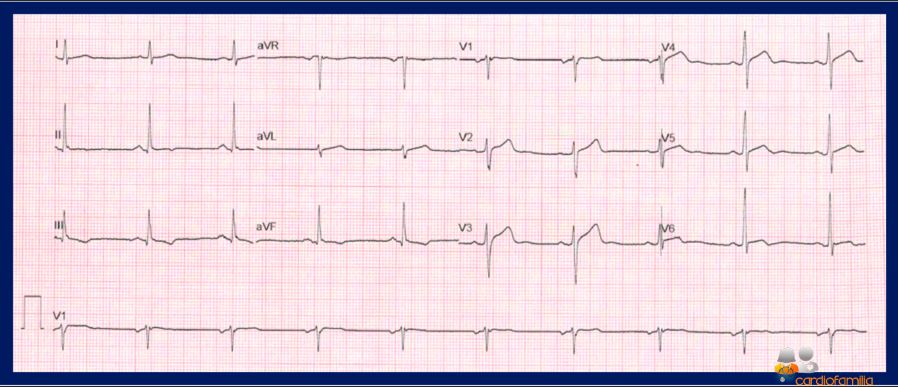 ecg20 07 2021