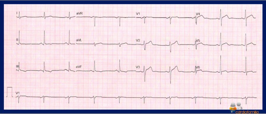 ecg20 07 2021