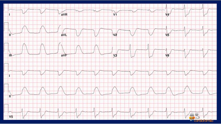 ecg22 07 2021