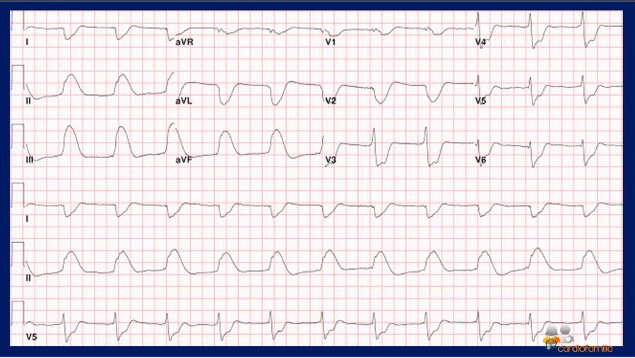 ecg22 07 2021