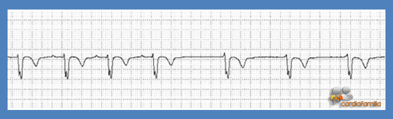 cardiofamilia 13.07.2017 ECG18