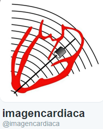 imagen cardiaca