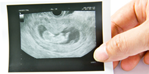 feto-problemas-cardivasculares-congenitos-por-toxinas-cardiofamilia-18.11.2013