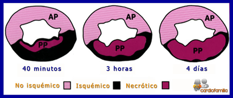 modelo experimental oclusion arteria coronaria www.cardiofamilia.org