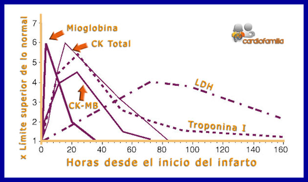 cinetica marcadores de necrosis infarto www.cardiofamilia.org