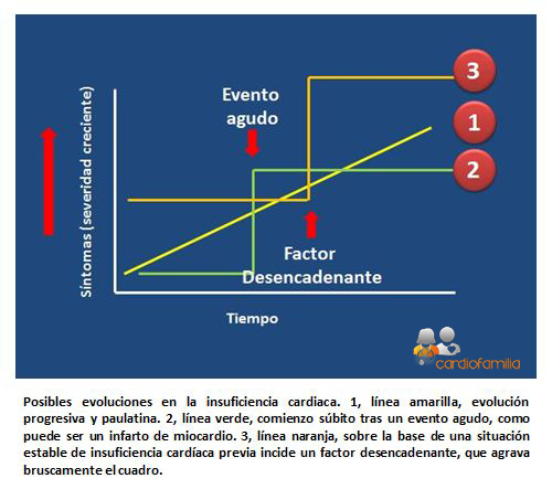 Formas presentacion insuficiencia cardiacax580