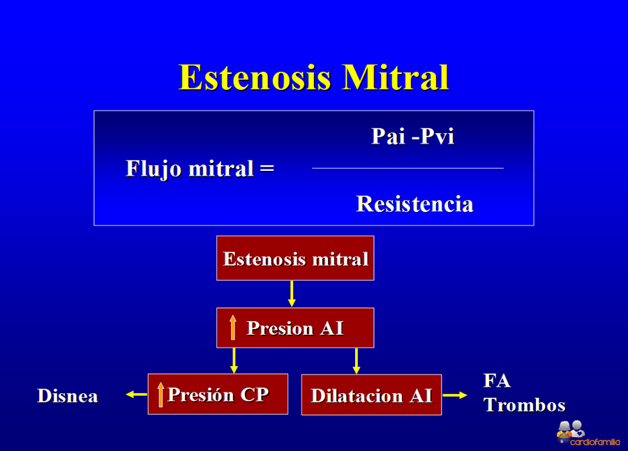 Diagrama_estenosis_mitralx580_www.cardiofamilia.org