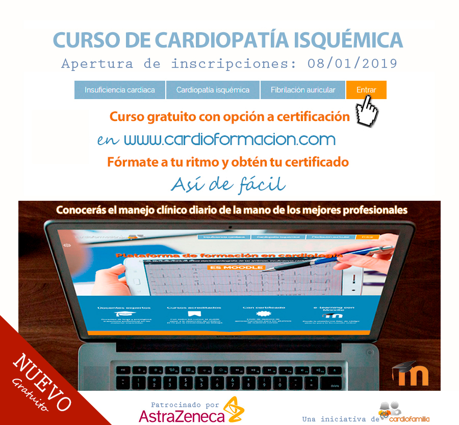 curso de electrocardiograma 2020 gratis