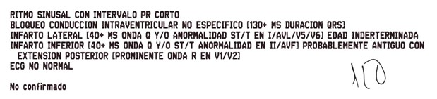 ECG marzo ED05 cardiofamilia machine result