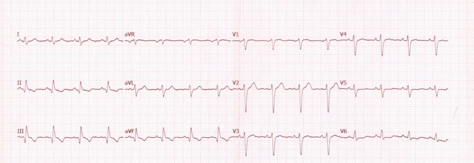 ECG 04.06.2019